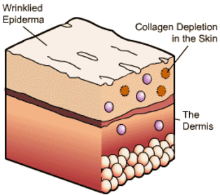 Mit 8: Nanašanje kolagena na kožo bo pripomoglo k tvorbi kolagena in elastina in izboljšalo stanje gub in gubic